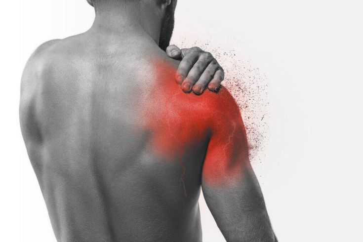 frozen shoulder